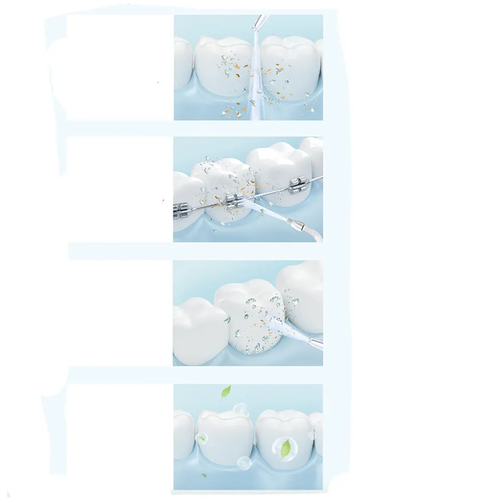 (6-piece set) 160ml Electric Water Pressure Water Flosser Oral Irrigator - White